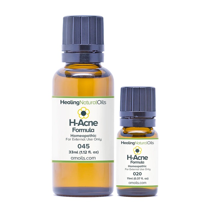 natural acne treatment h-acne formula